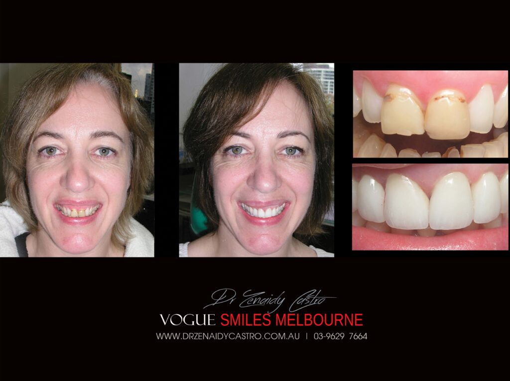 VOGUE-SMILES-COSMETIC-DENTISTRY