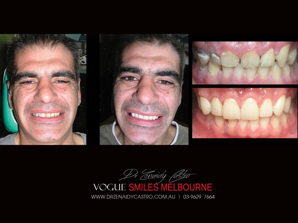 VOGUE-SMILES-COSMETIC-DENTISTRY