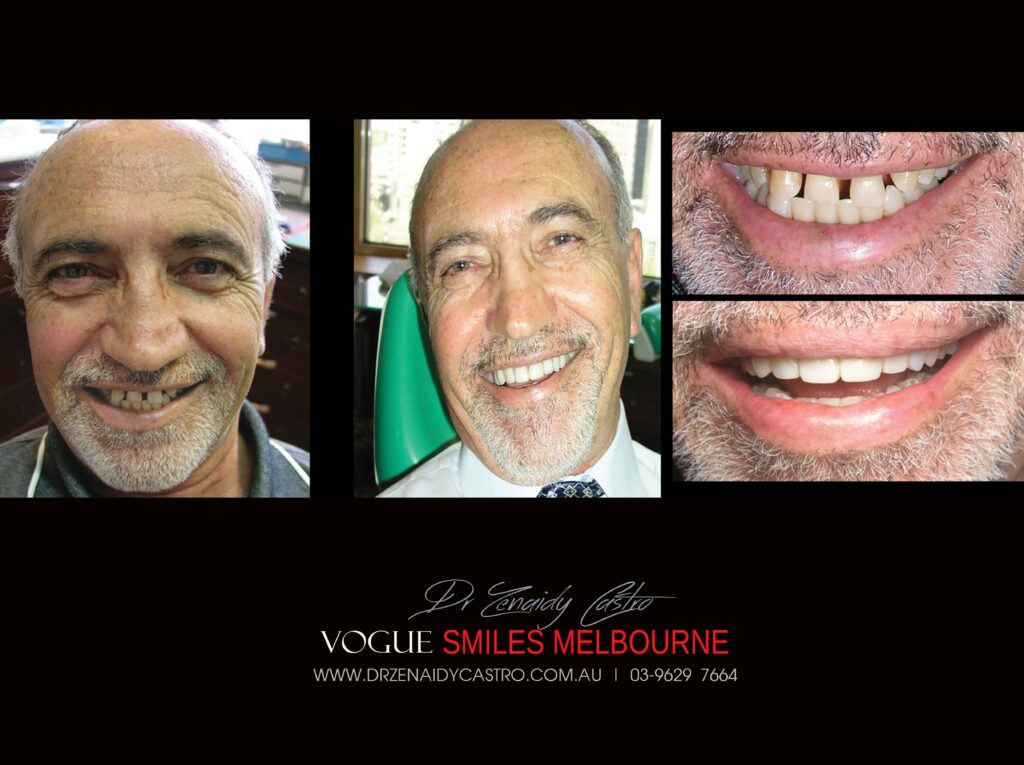 VOGUE-SMILES-COSMETIC-DENTISTRY
