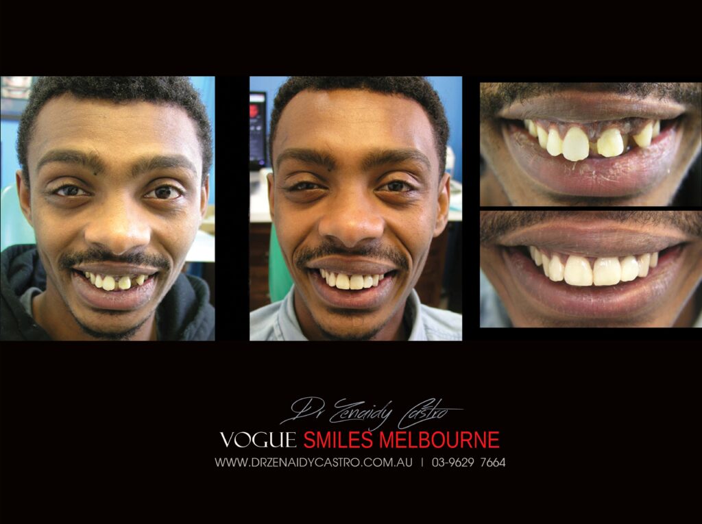 VOGUE-SMILES-COSMETIC-DENTISTRY