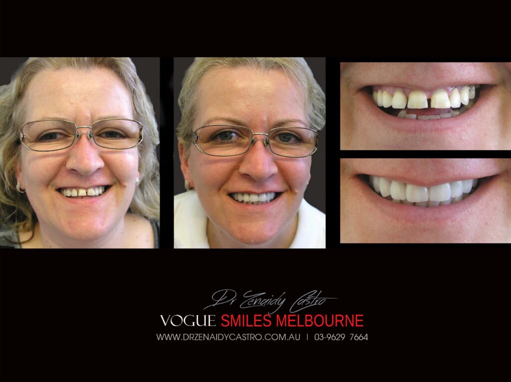 VOGUE-SMILES-COSMETIC-DENTISTRY