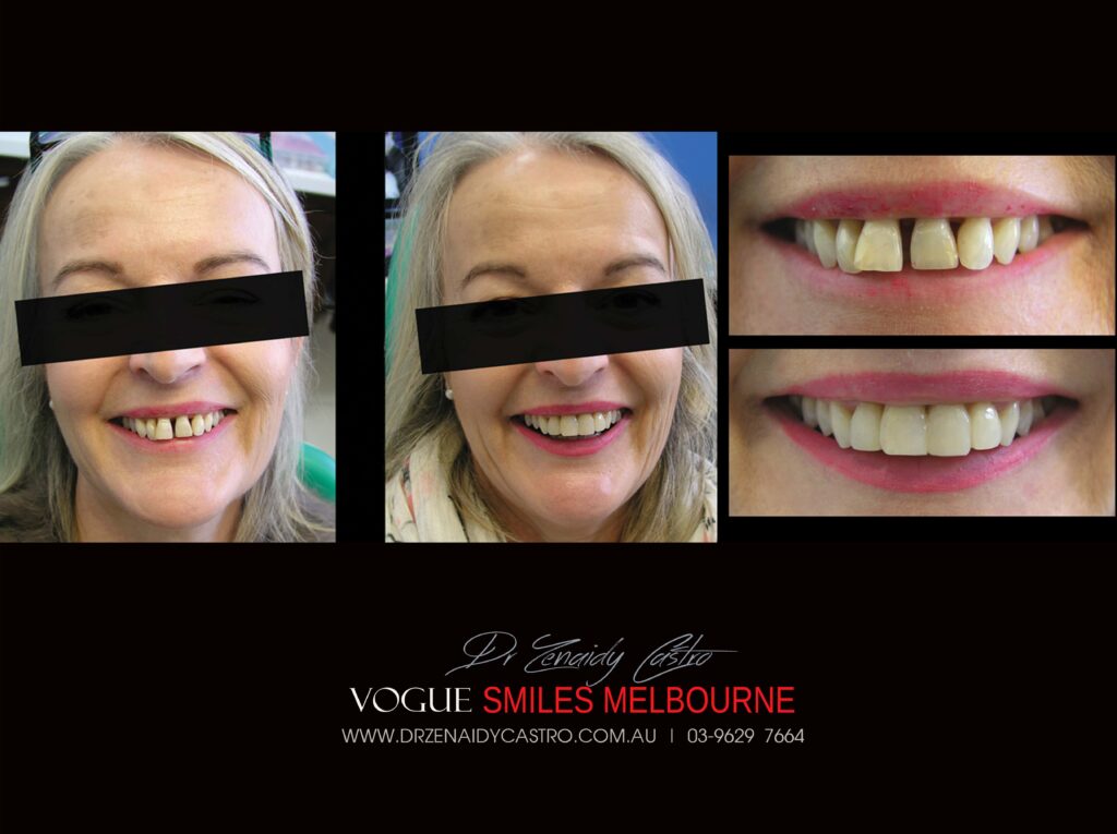 VOGUE-SMILES-COSMETIC-DENTISTRY