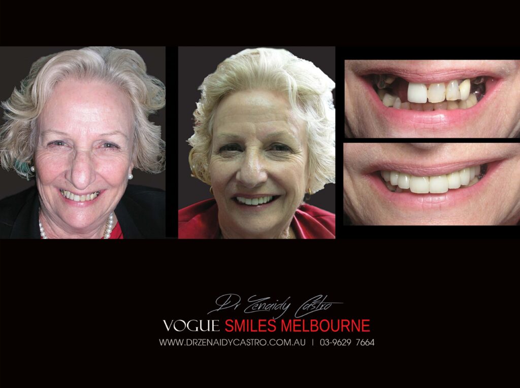 VOGUE-SMILES-COSMETIC-DENTISTRY