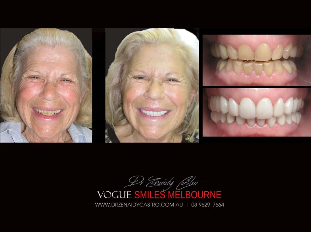 VOGUE-SMILES-COSMETIC-DENTISTRY