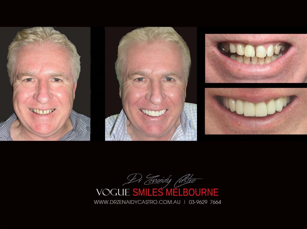 VOGUE-SMILES-COSMETIC-DENTISTRY-TREATMENT