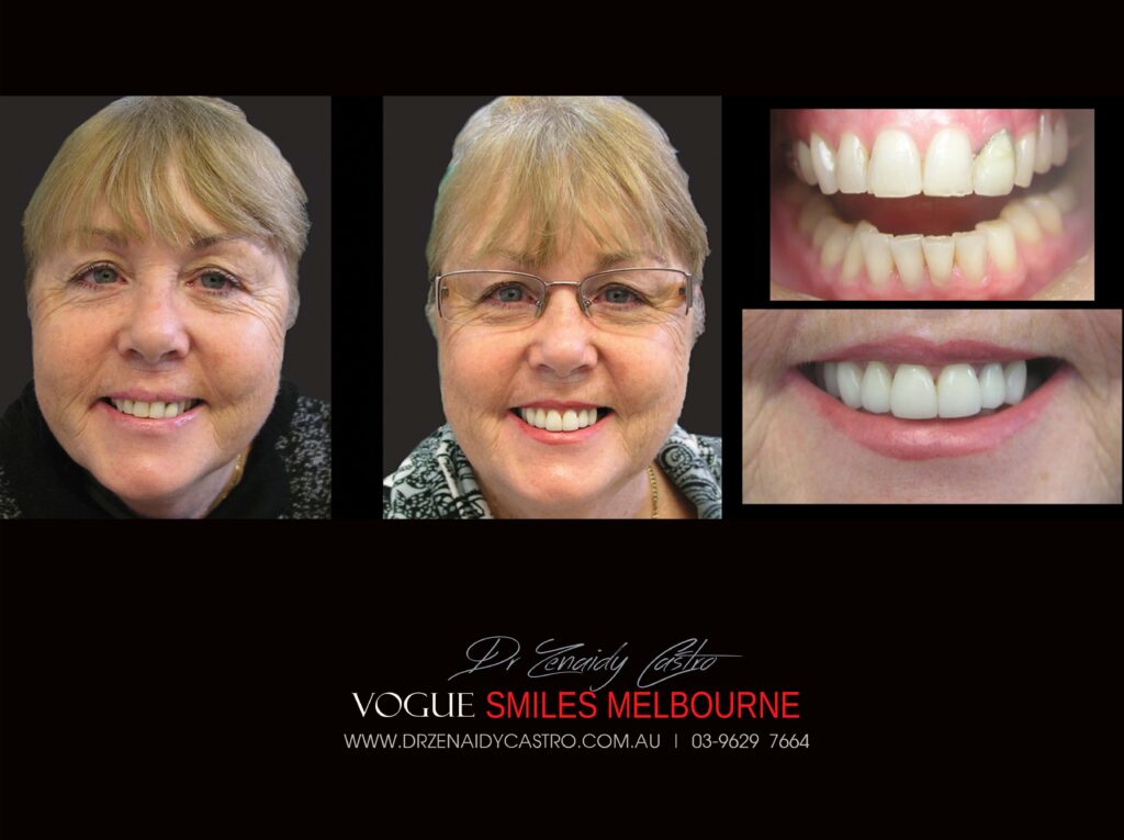 VOGUE-SMILES-COSMETIC-DENTISTRY-TREATMENT