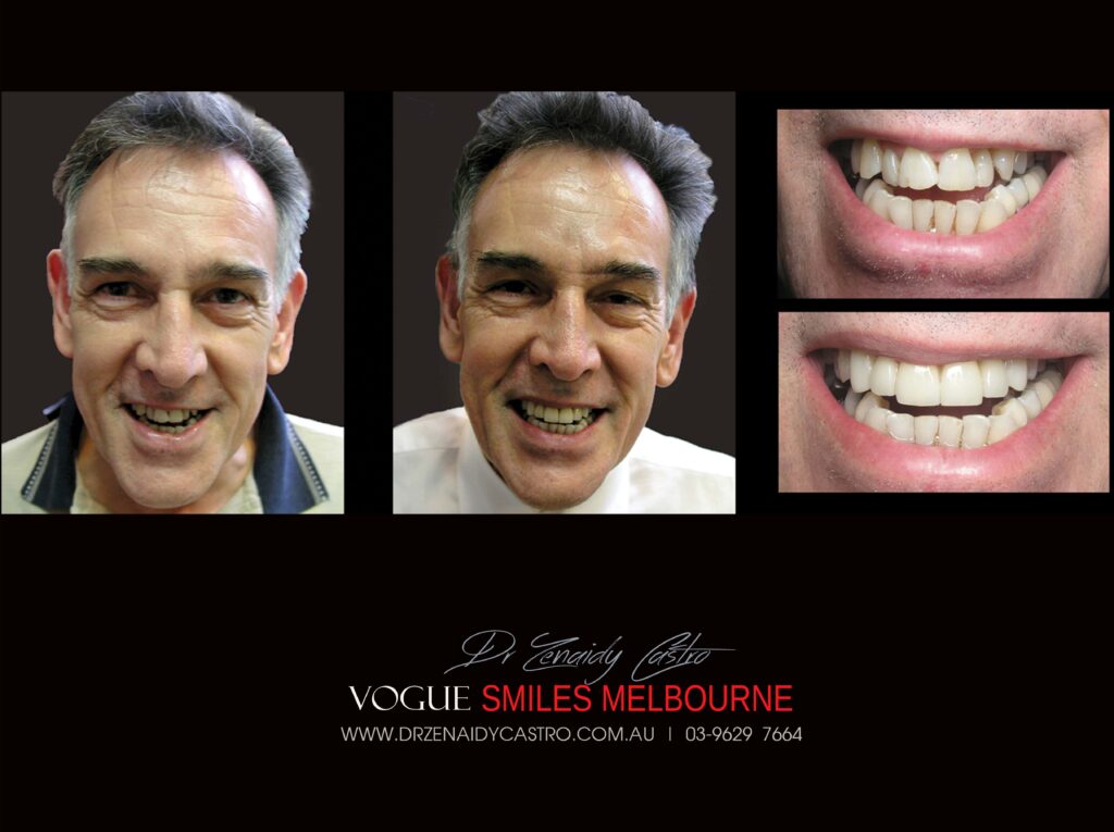 VOGUE-SMILES-COSMETIC-DENTISTRY-TREATMENT