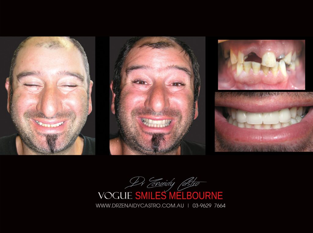 VOGUE-SMILES-COSMETIC-DENTISTRY