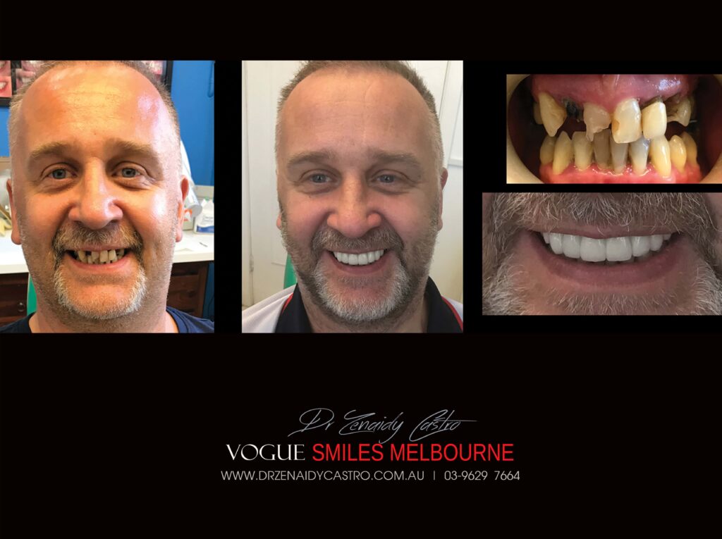 VOGUE-SMILES-COSMETIC-DENTISTRY-TREATMENT