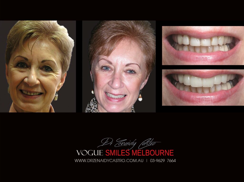 VOGUE-SMILES-COSMETIC-DENTISTRY-TREATMENT