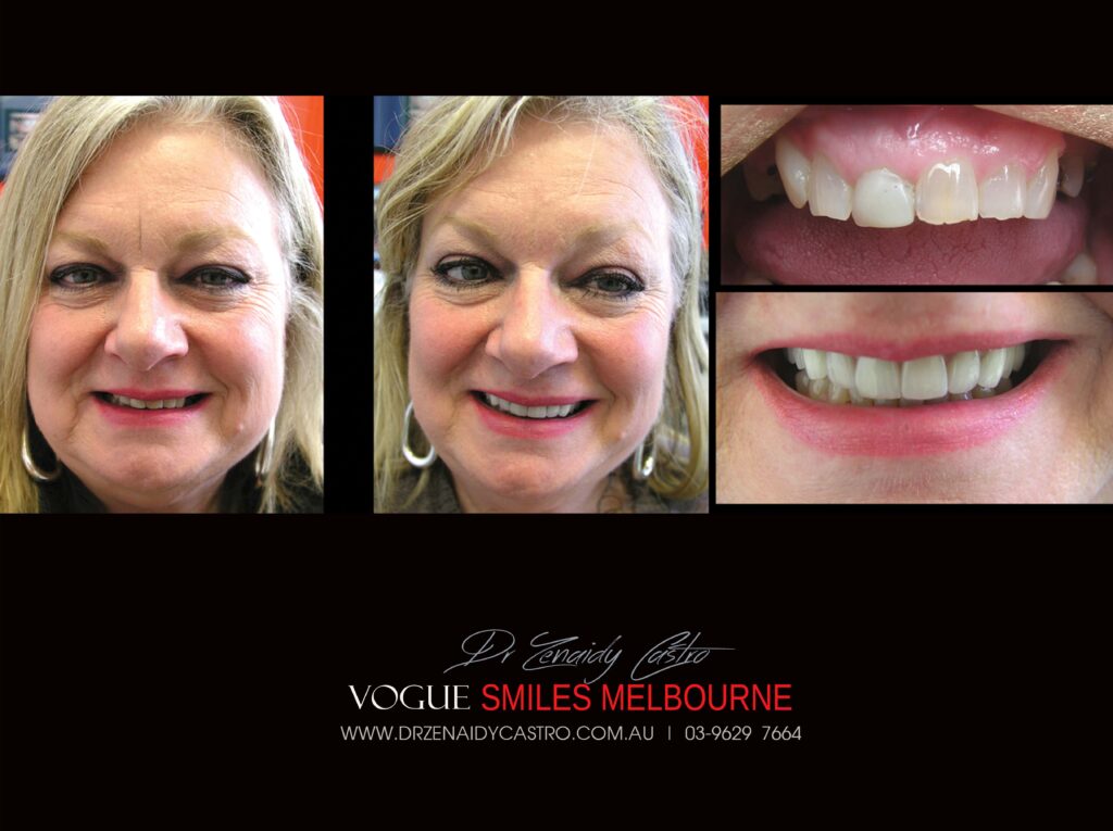 VOGUE-SMILES-COSMETIC-DENTISTRY-TREATMENT