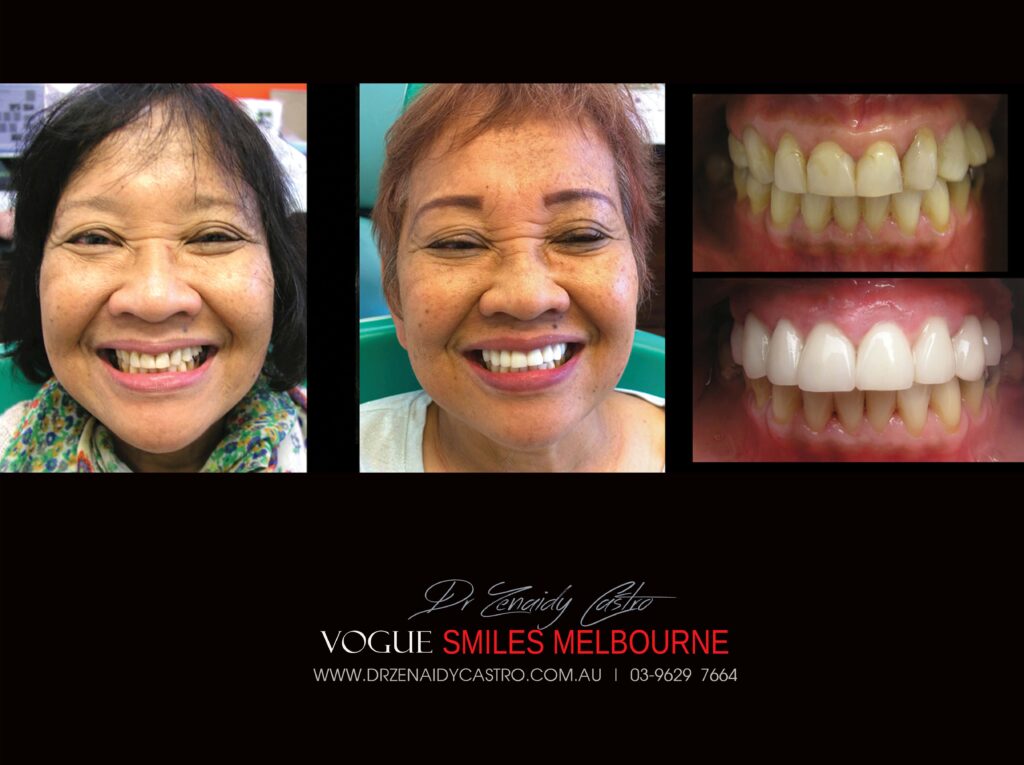 VOGUE-SMILES-COSMETIC-DENTISTRY-TREATMENT