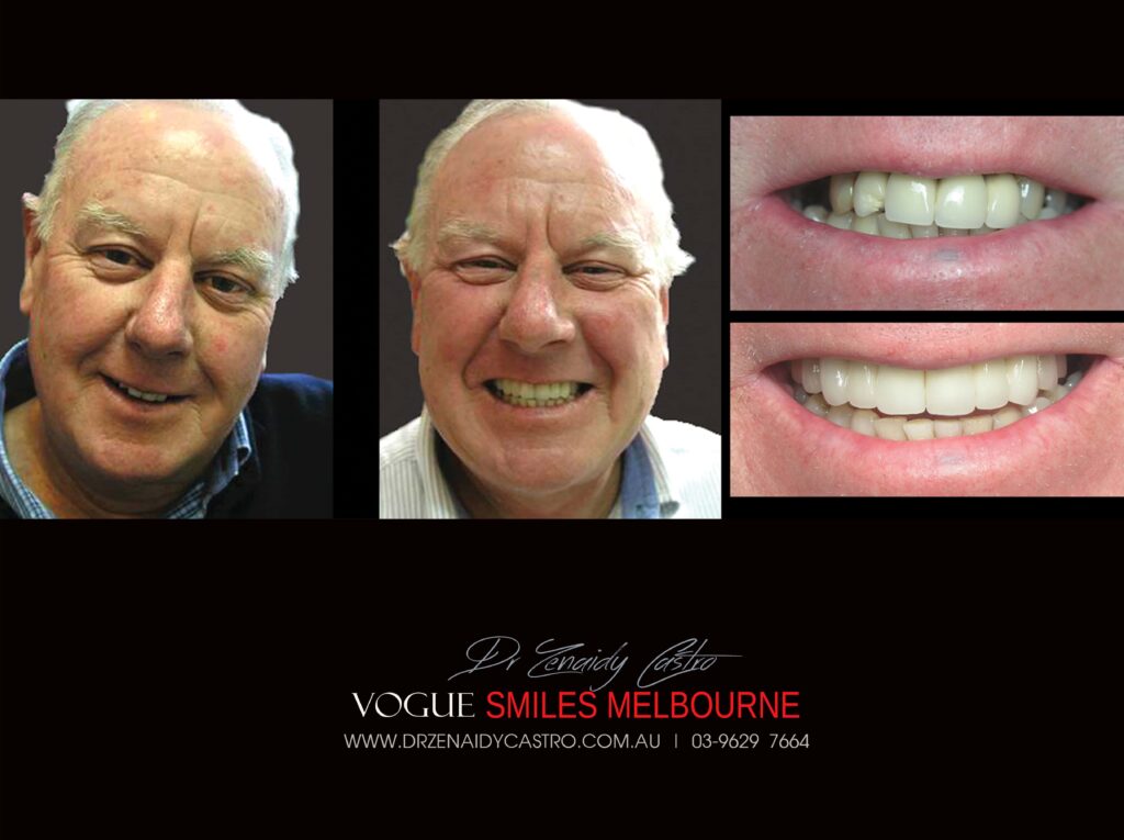 VOGUE-SMILES-COSMETIC-DENTISTRY-TREATMENT
