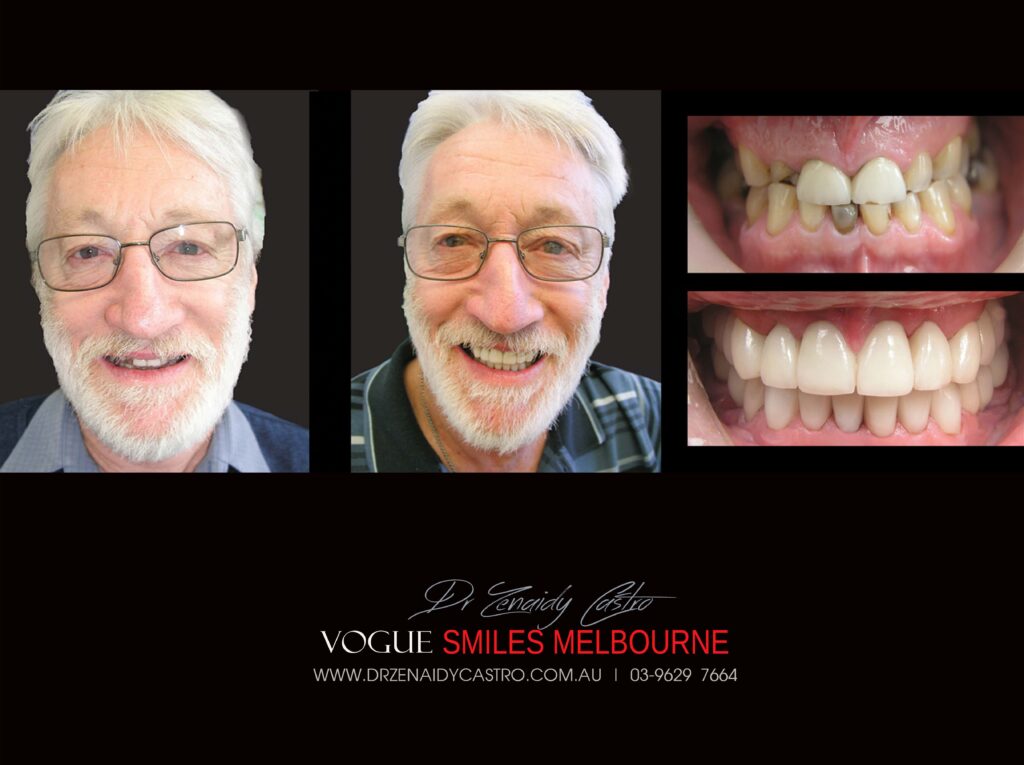 VOGUE-SMILES-COSMETIC-DENTISTRY-TREATMENT