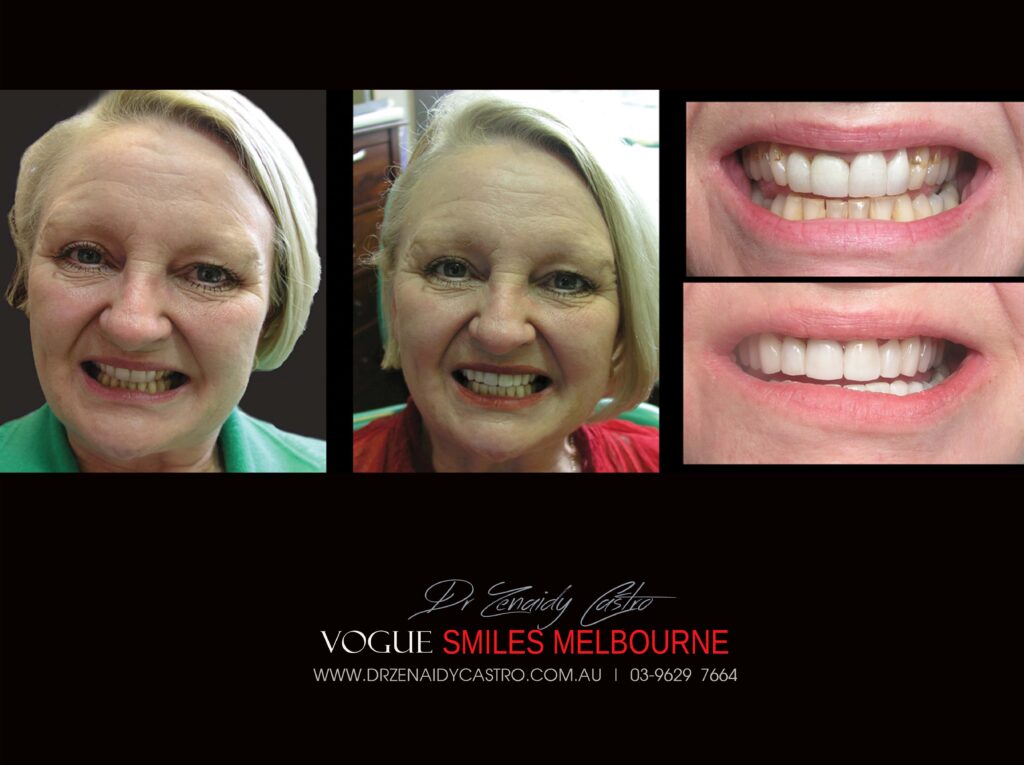 VOGUE-SMILES-COSMETIC-DENTISTRY-TREATMENT