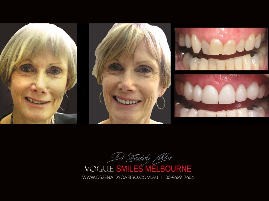 VOGUE-SMILES-COSMETIC-DENTISTRY-TREATMENT