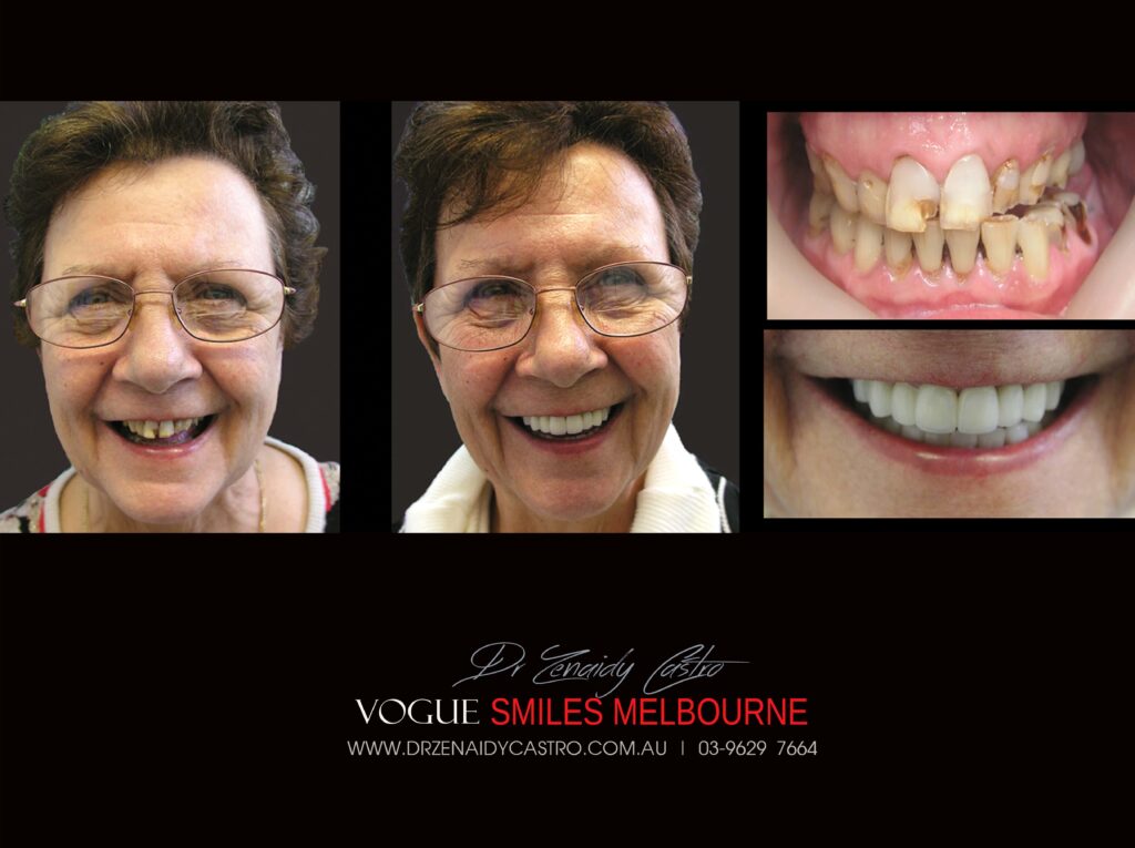 VOGUE-SMILES-COSMETIC-DENTISTRY-TREATMENT