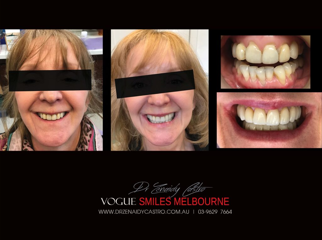 VOGUE-SMILES-COSMETIC-DENTISTRY-TREATMENT