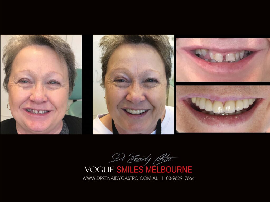 VOGUE-SMILES-COSMETIC-DENTISTRY