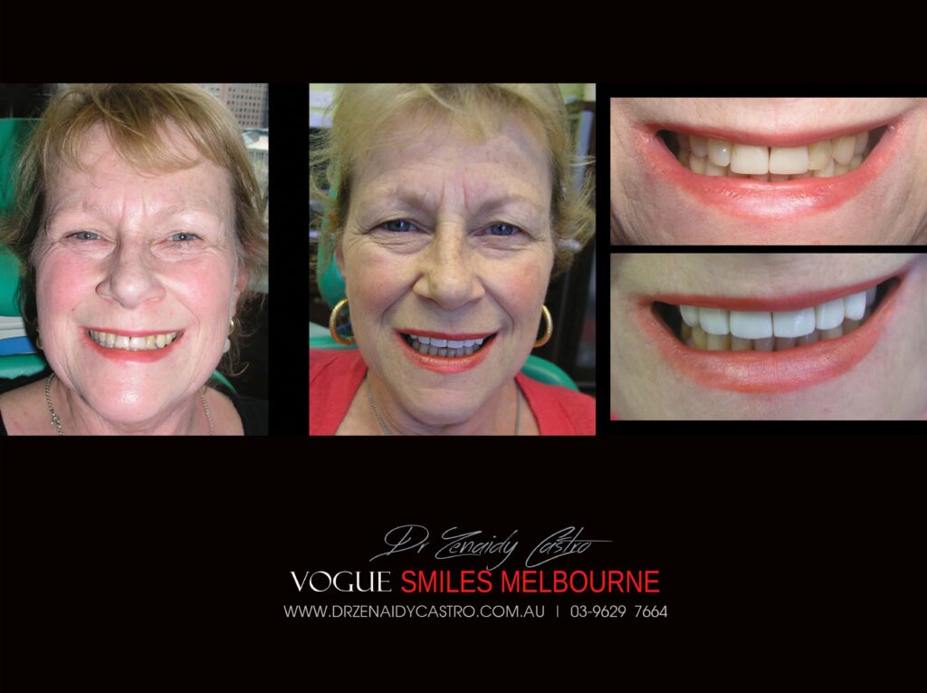 VOGUE-SMILES-COSMETIC-DENTISTRY-TREATMENT
