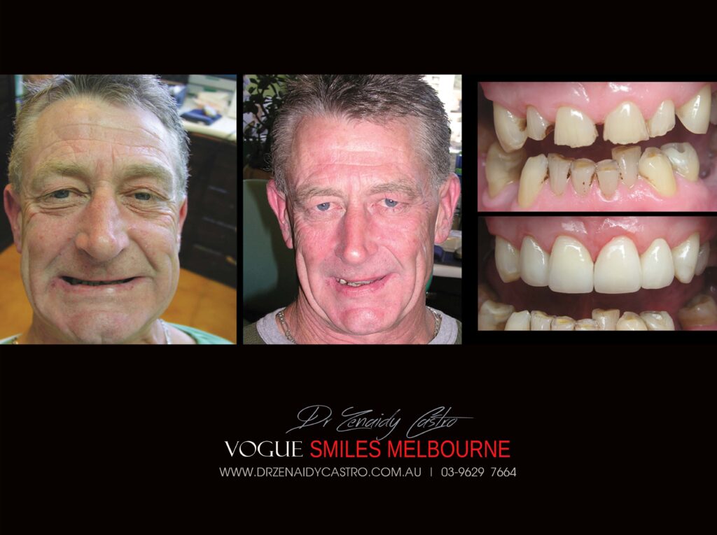 VOGUE-SMILES-COSMETIC-DENTISTRY-TREATMENT