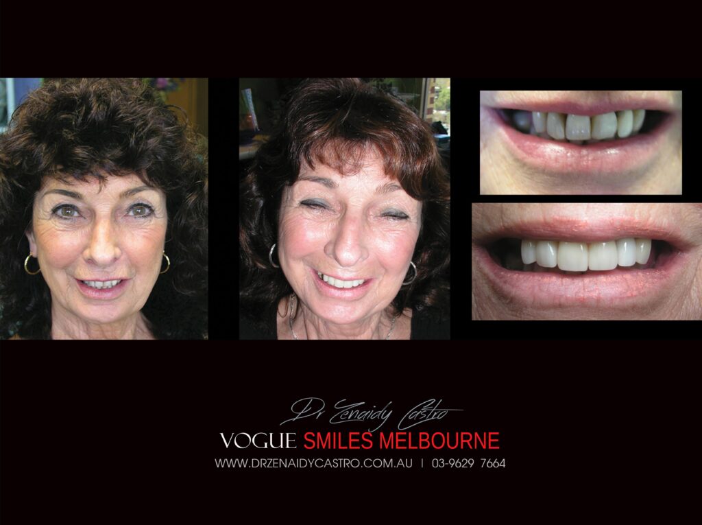 VOGUE-SMILES-COSMETIC-DENTISTRY-TREATMENT