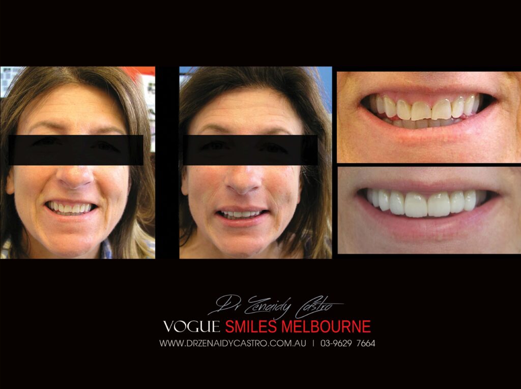 VOGUE-SMILES-COSMETIC-DENTISTRY-TREATMENT