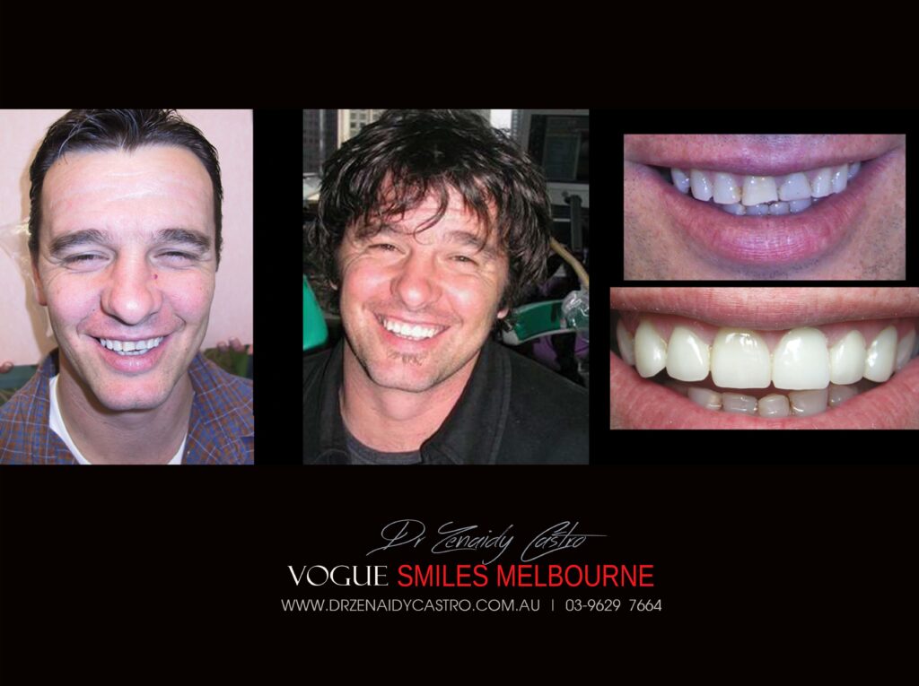 VOGUE-SMILES-COSMETIC-DENTISTRY-TREATMENT