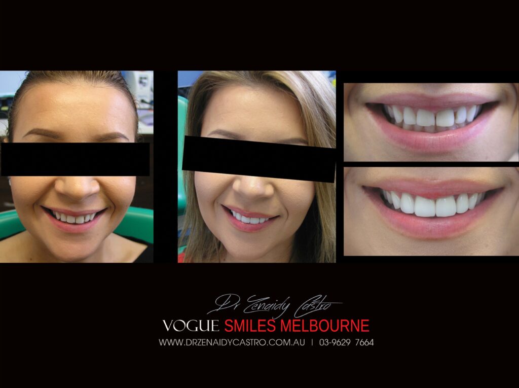 VOGUE-SMILES-COSMETIC-DENTISTRY-TREATMENT