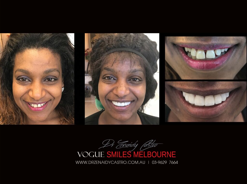 VOGUE-SMILES-COSMETIC-DENTISTRY-TREATMENT
