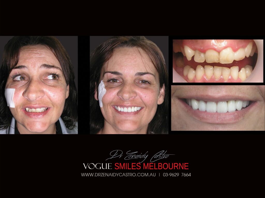 VOGUE-SMILES-COSMETIC-DENTISTRY-TREATMENT