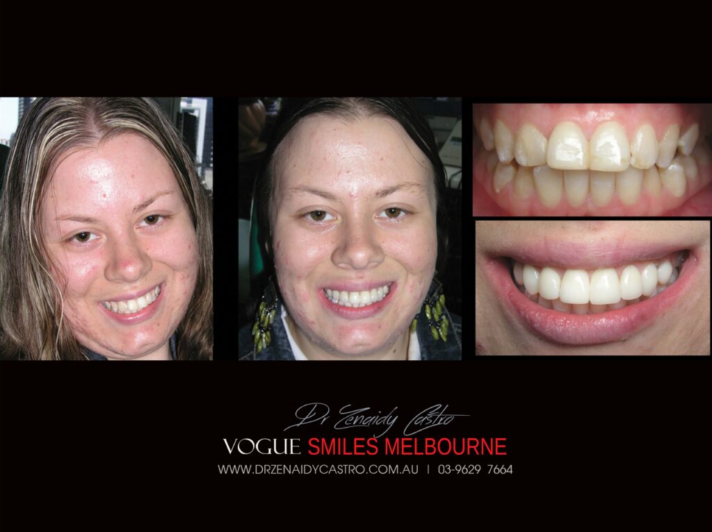 VOGUE-SMILES-COSMETIC-DENTISTRY-TREATMENT