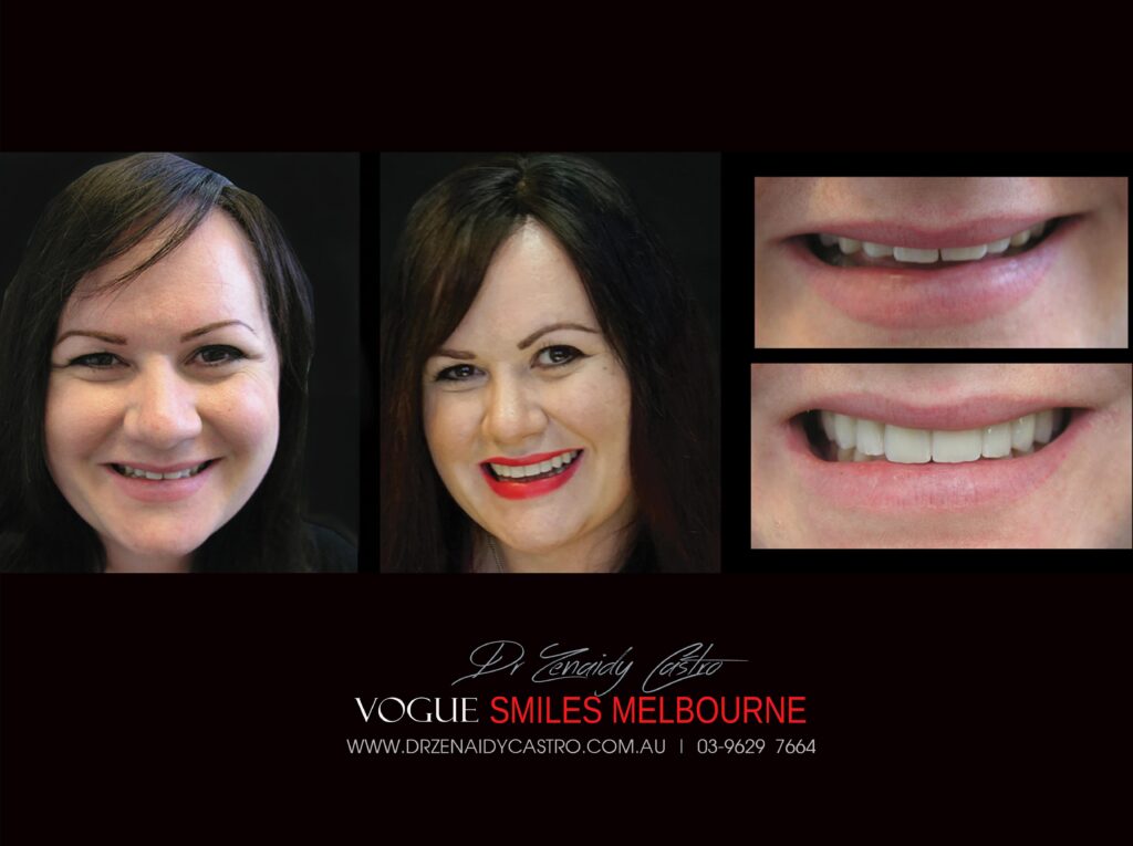 VOGUE-SMILES-COSMETIC-DENTISTRY-TREATMENT
