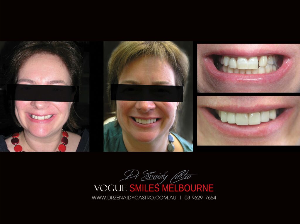 VOGUE-SMILES-COSMETIC-DENTISTRY-TREATMENT
