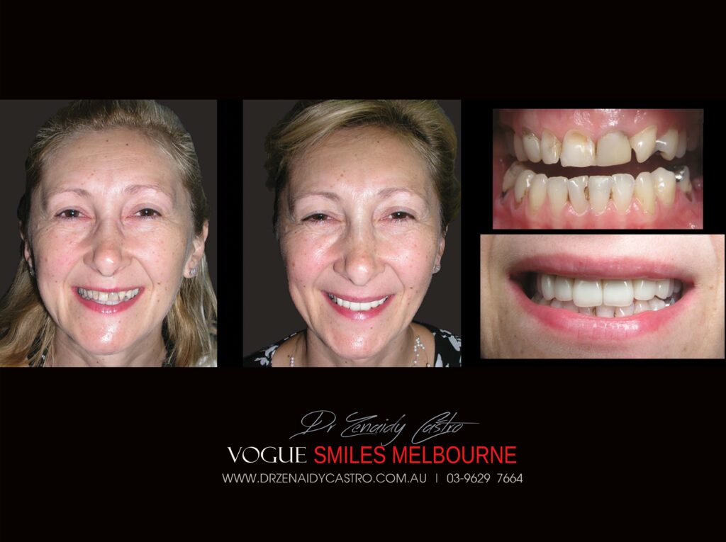 VOGUE-SMILES-COSMETIC-DENTISTRY-TREATMENT