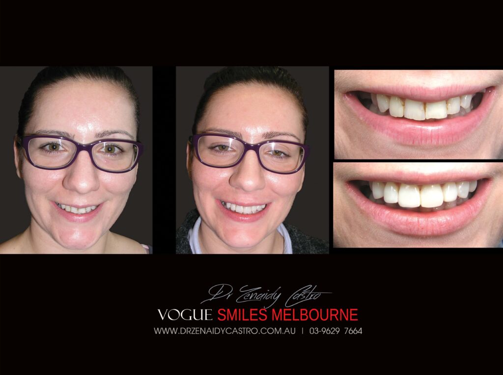 VOGUE-SMILES-COSMETIC-DENTISTRY-TREATMENT