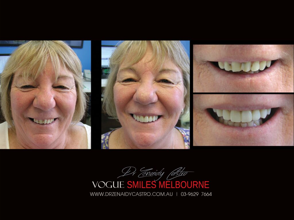 VOGUE-SMILES-COSMETIC-DENTISTRY-TREATMENT