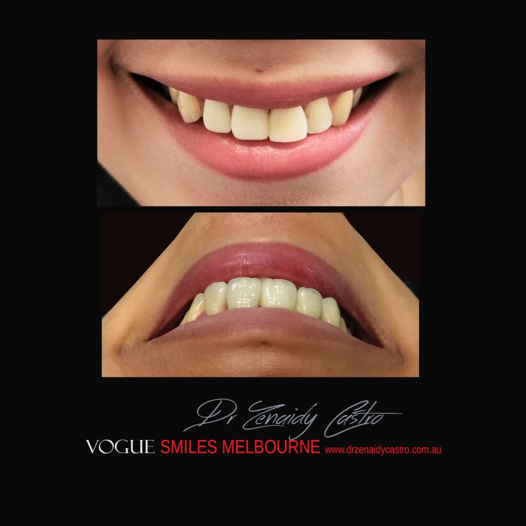 VOGUE-SMILES-COSMETIC-DENTISTRY-TREATMENT