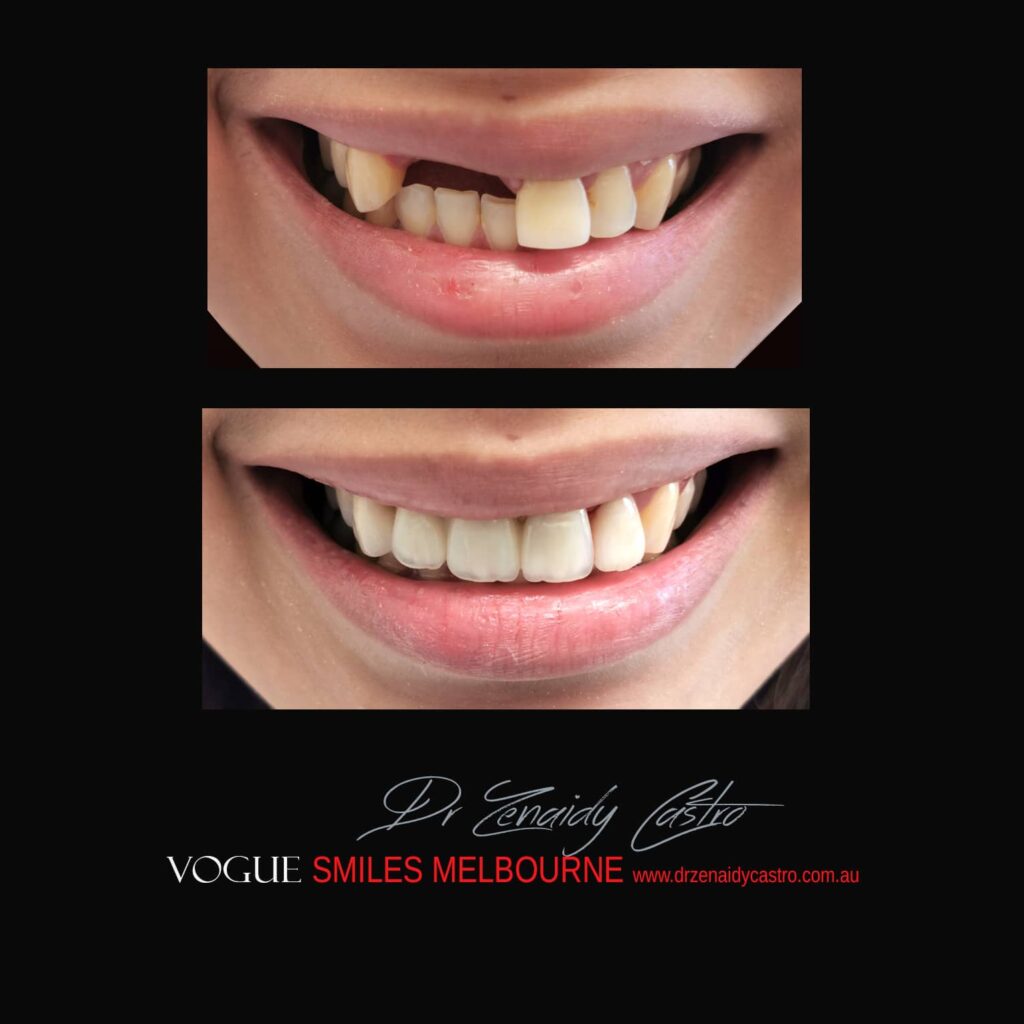 VOGUE-SMILES-COSMETIC-DENTISTRY-TREATMENT