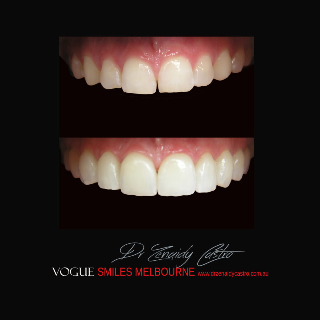 VOGUE-SMILES-COSMETIC-DENTISTRY-TREATMENT