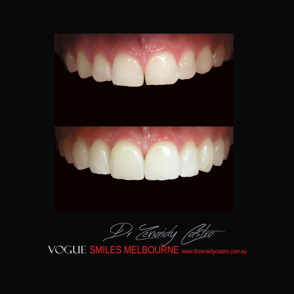 VOGUE-SMILES-COSMETIC-DENTISTRY-TREATMENT