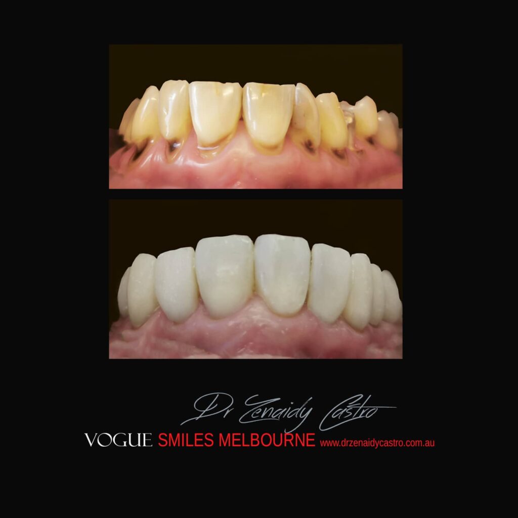 VOGUE-SMILES-COSMETIC-DENTISTRY-TREATMENT