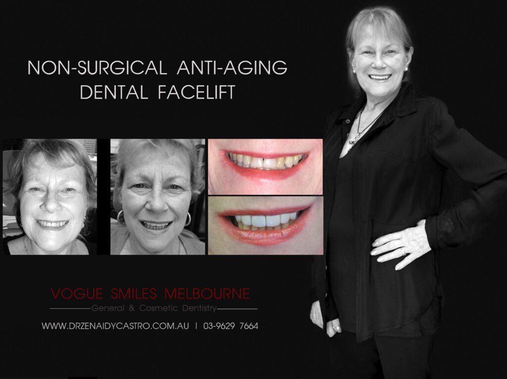 VOGUE-SMILES-COSMETIC-DENTISTRY