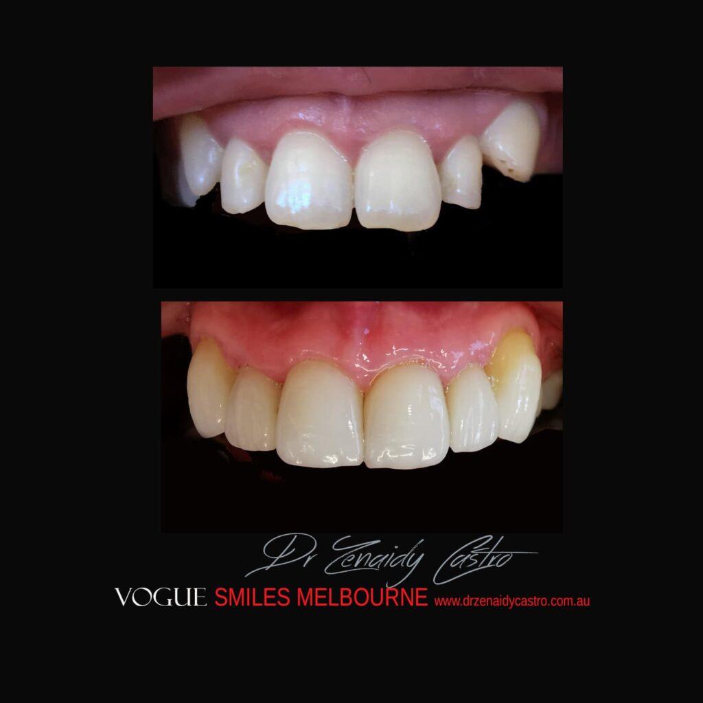 VOGUE-SMILES-COSMETIC-DENTISTRY-TREATMENT