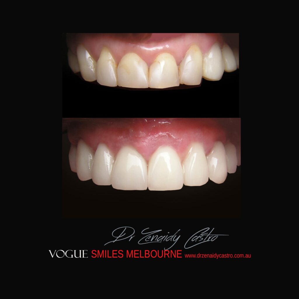 VOGUE-SMILES-COSMETIC-DENTISTRY-TREATMENT