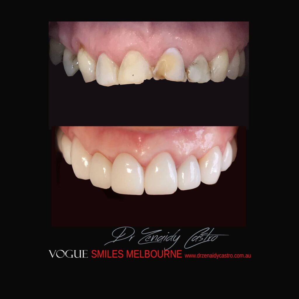 VOGUE-SMILES-COSMETIC-DENTISTRY-TREATMENT