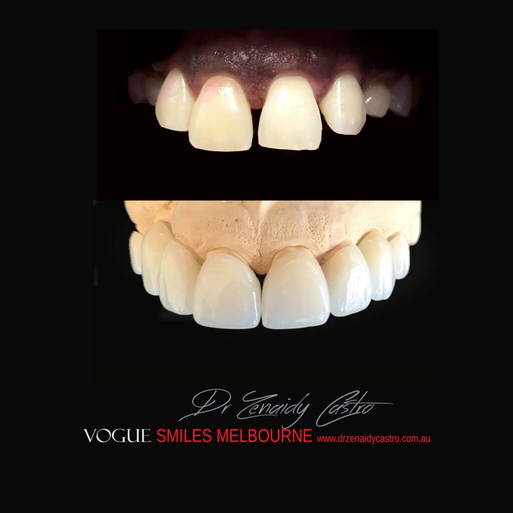 VOGUE-SMILES-COSMETIC-DENTISTRY-TREATMENT