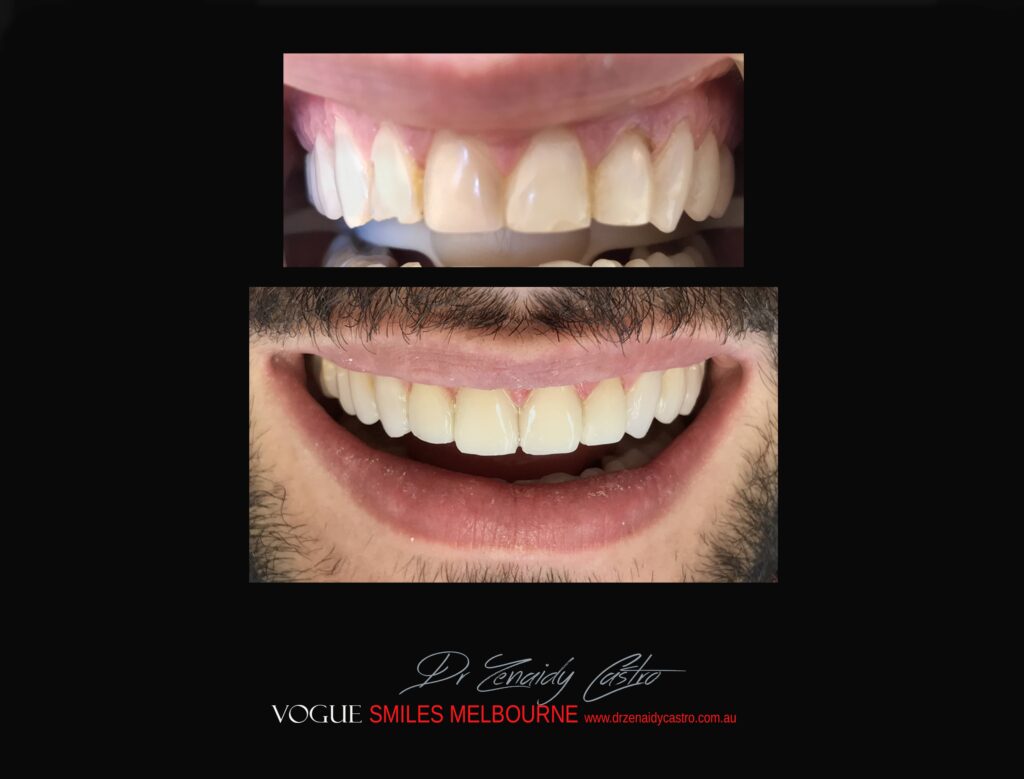 VOGUE-SMILES-COSMETIC-DENTISTRY-TREATMENT