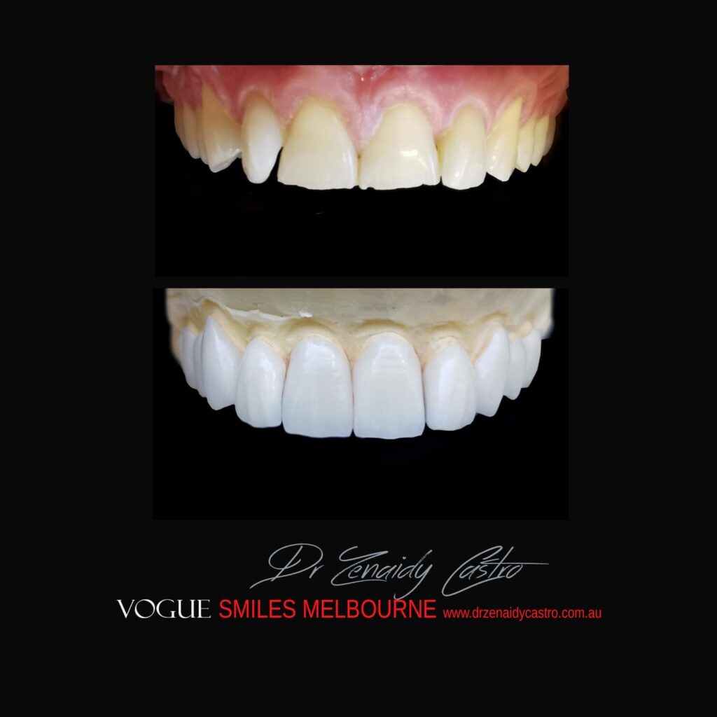 VOGUE-SMILES-COSMETIC-DENTISTRY-TREATMENT