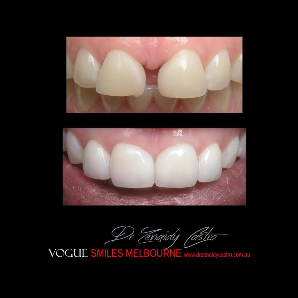 VOGUE-SMILES-COSMETIC-DENTISTRY-TREATMENT